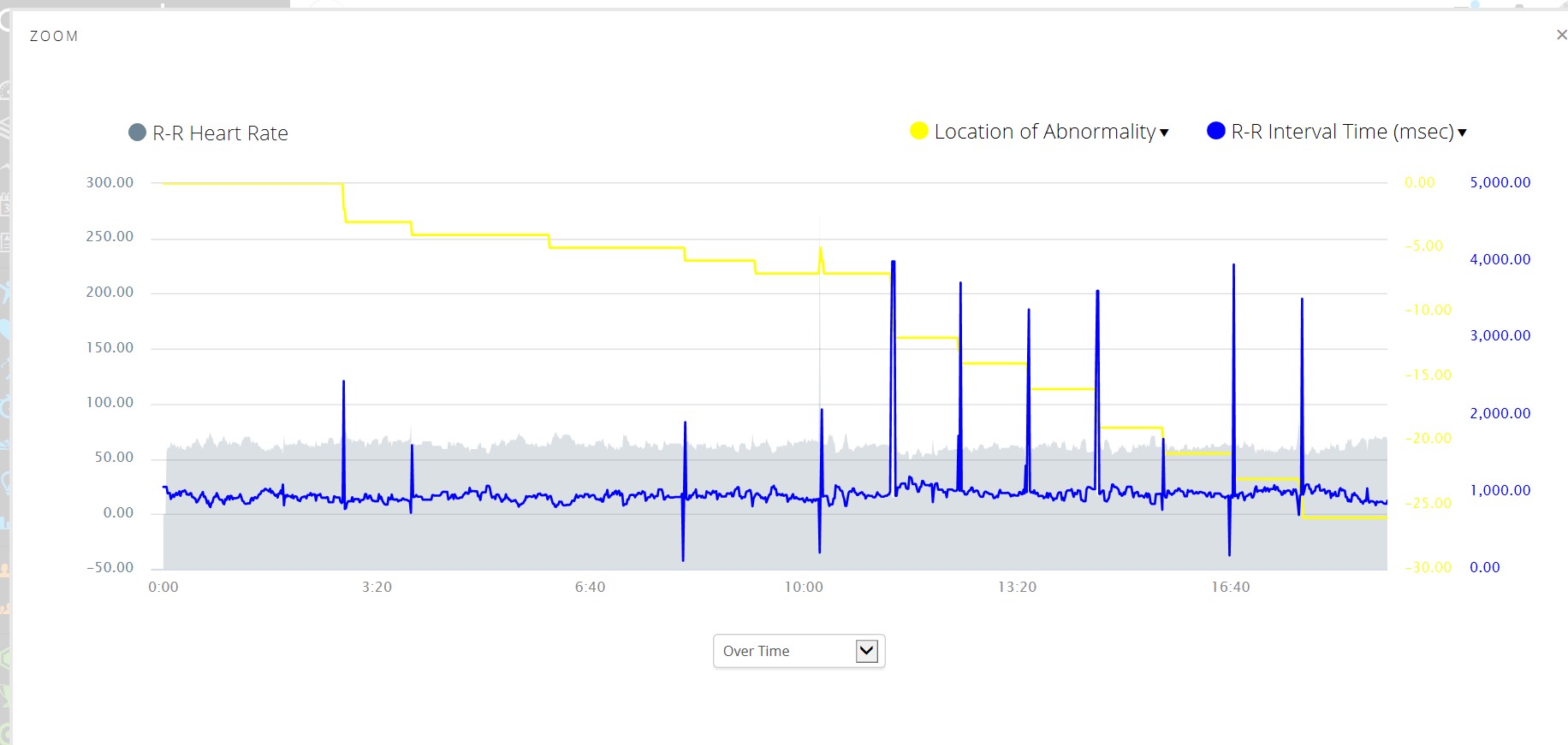 F3b Heart Monitor (datafield) screenshot 1