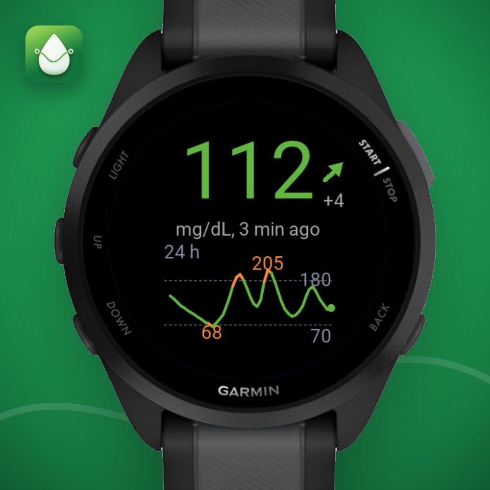 Sugar Sense - CGM Glucose Libre Dexcom Nightscout · Screenshot 2