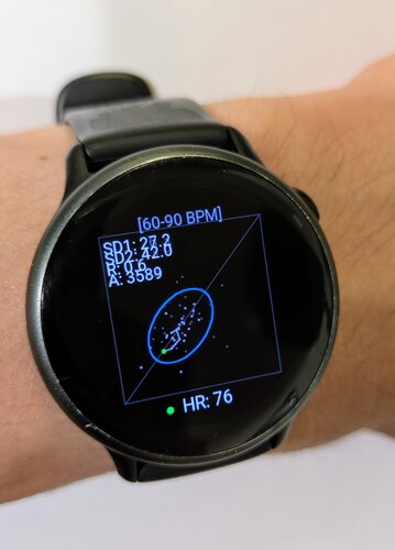 POINCARÉ HRV VISUALIZER · Screenshot 1