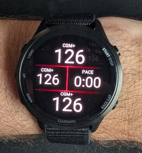 CGM+ Datafield (Dexcom, Libre, Nightscout, xDrip+) screenshot 2