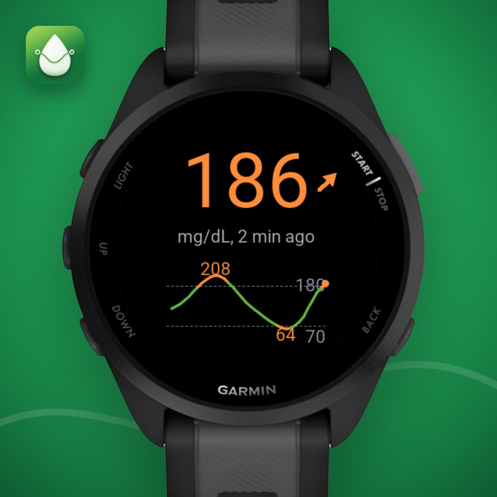Sugar Sense - CGM Glucose Libre Dexcom Nightscout · Screenshot 0