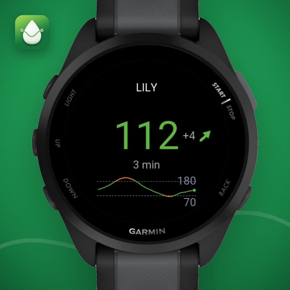 Sugar Sense - Glucose Data Field Libre Dexcom · Screenshot 2