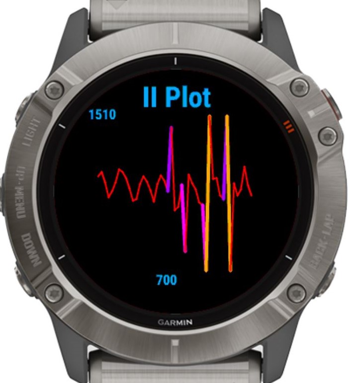 Long duration HRV analysis (up to 24hrs) · Screenshot 3